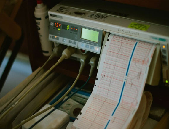 ECG with instant reporting