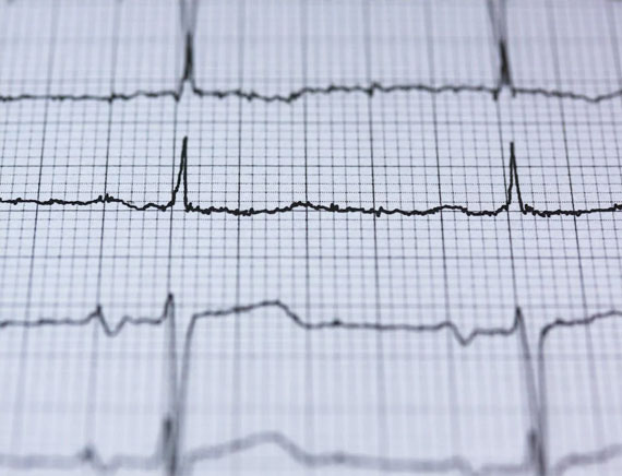 ECG with instant reporting